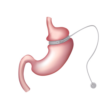 fotolia_165659805_xs.jpg